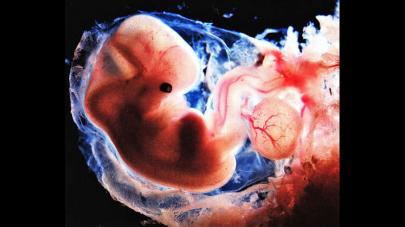 Crean embriones de humano y mono para desarrollar órganos de trasplante